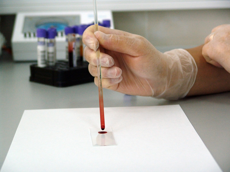 Important Information You Should Consider Regarding Animal Research