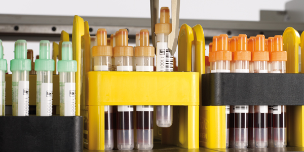 Essentials of Sample Management for Commercial Product Testing Laboratories